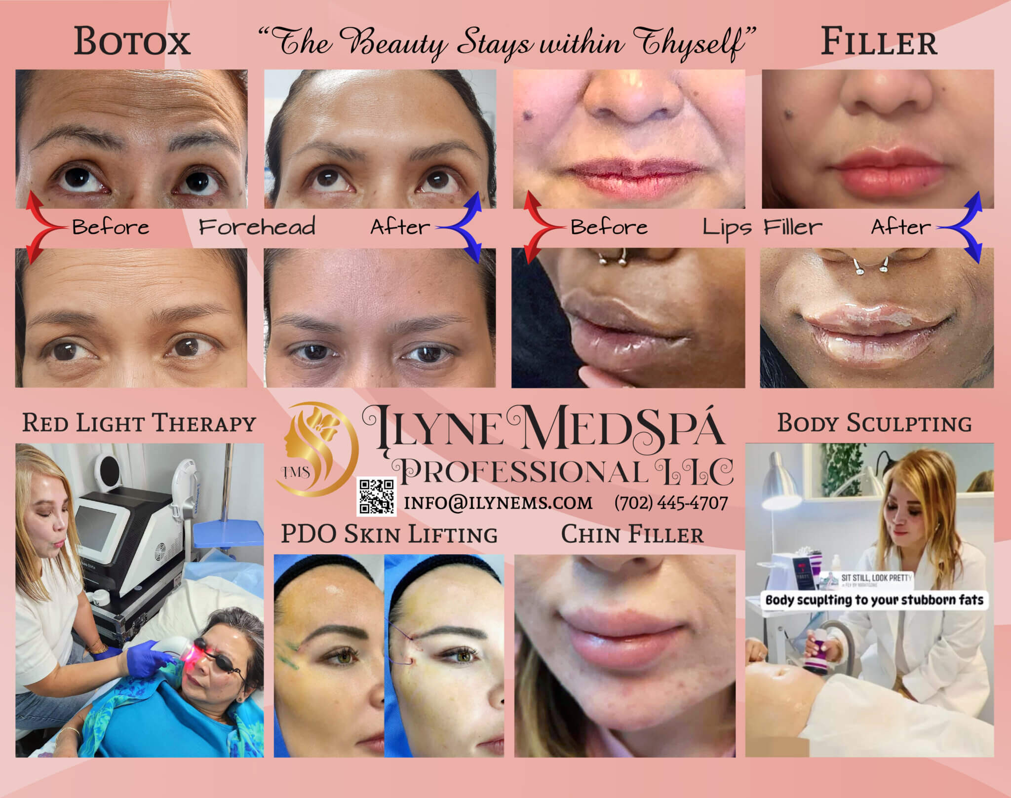 Ilyne Med Spa
